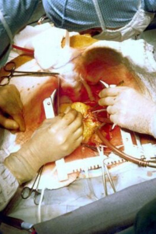 "The Heart" 40 Years Later (2016) poster