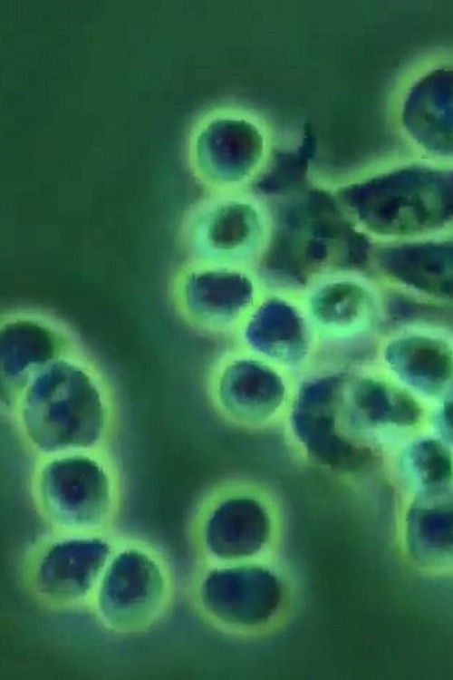 ERYTHROPOIEISIS AND ERYTHROPOIETIN (1989) poster