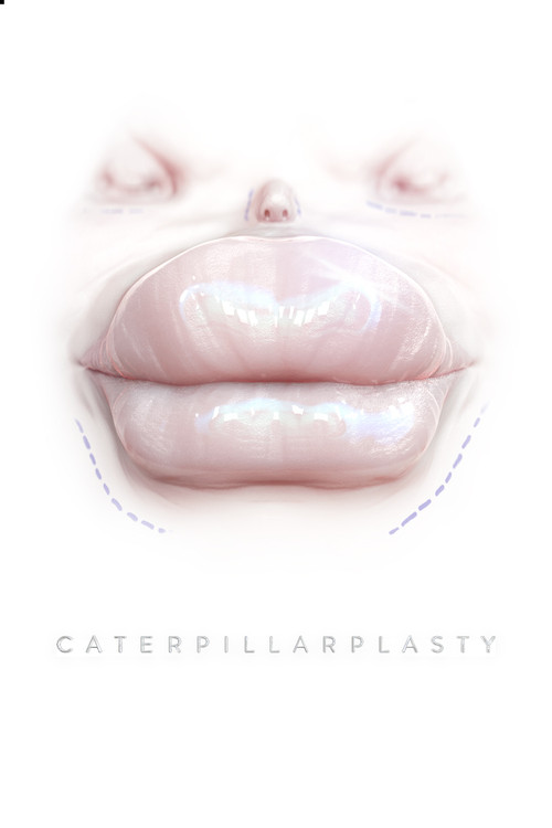 Caterpillarplasty (2018) poster