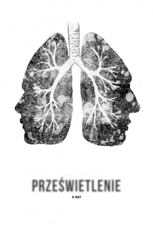 Prześwietlenie (1974) poster