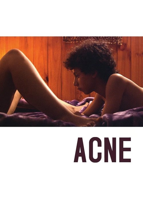 Acne (2008) poster