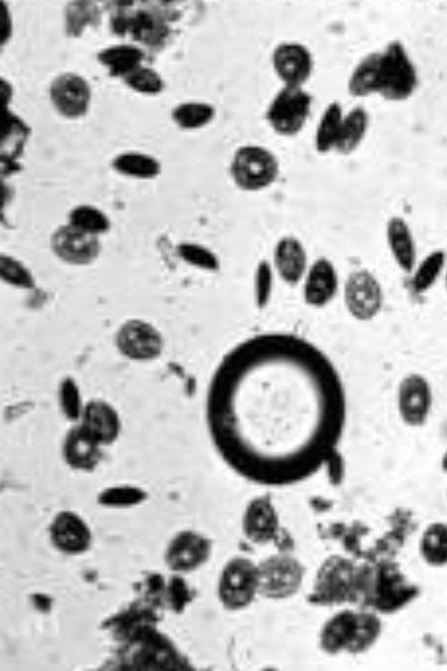 Anthony van Leeuwenhoek (1924) poster