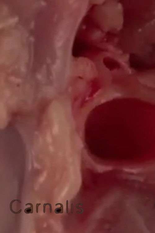 Carnalis (2011) poster
