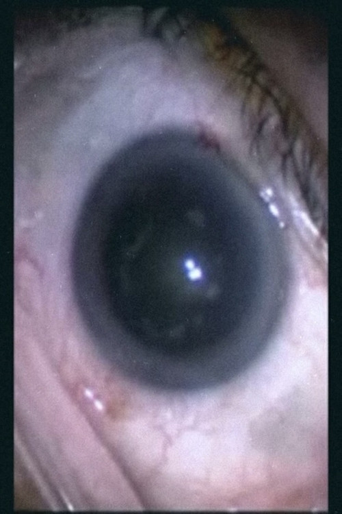 Botched Eyeball Operation (2007) poster