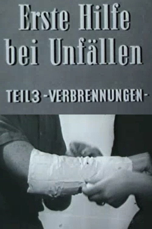 Erste Hilfe bei Unfällen: Verbrennungen (1960) poster