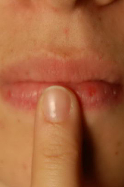 Lay Bare (2012) poster