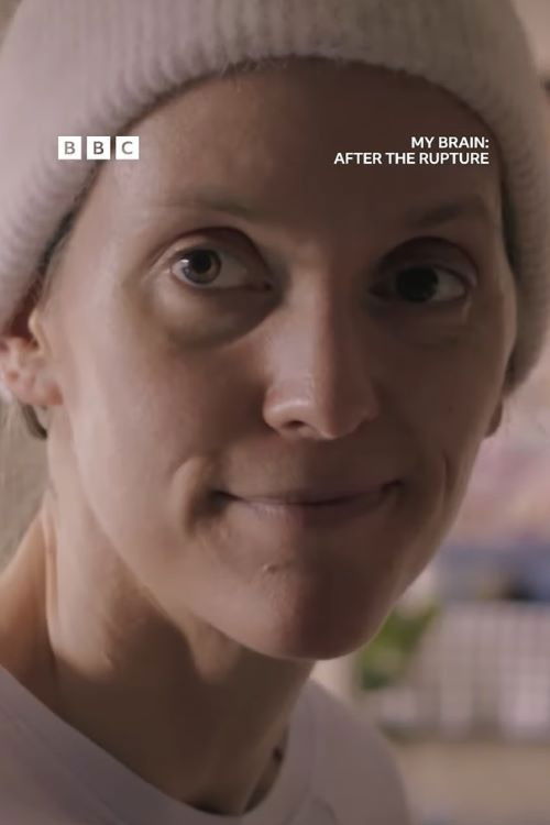 My Brain: After the Rupture (2025) poster