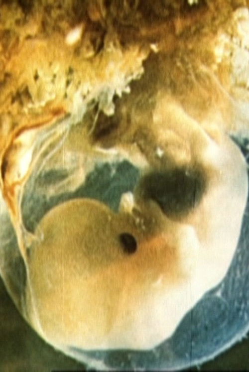 Schwangerschaft und Geburt (1982) poster