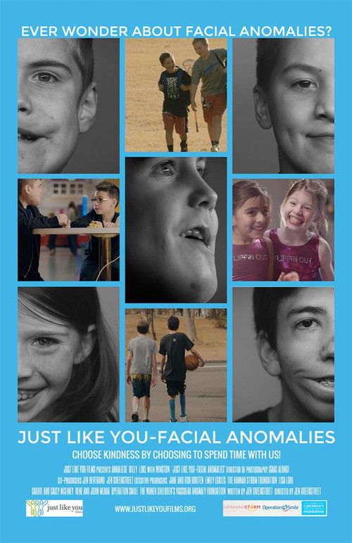 Just Like You: Facial Anomalies (2017) poster