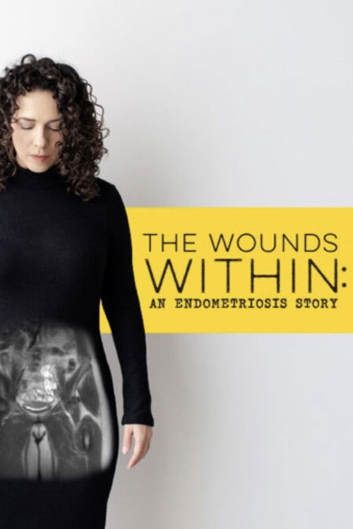 The Wounds Within: An Endometriosis Story (2024) poster