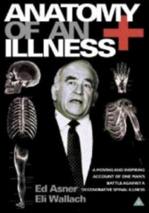 Anatomy of an Illness (1984) poster
