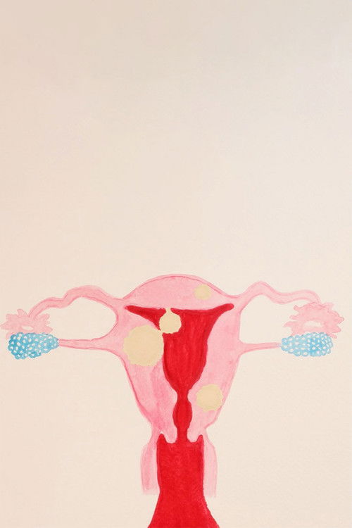 Bloody Mess (2024) poster