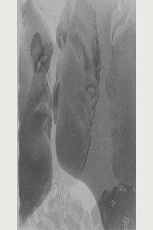 Vis à Vis (2013) poster