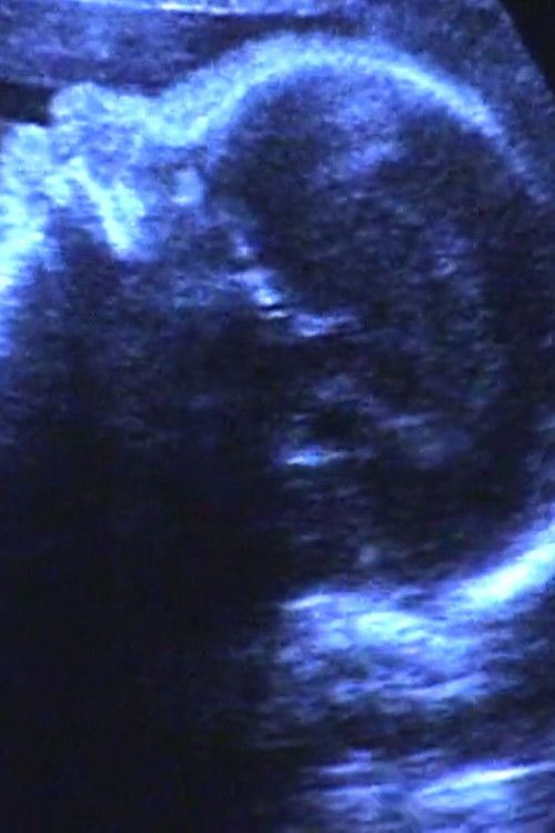 A Short Film for Lida (2003) poster