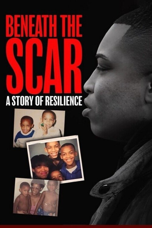 Beneath the Scar: A Story of Resilience (2025) poster
