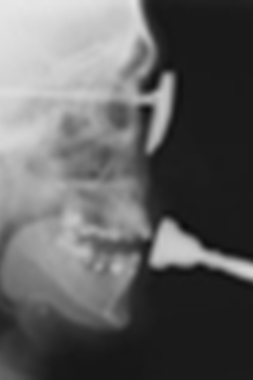 Studies in Diagnostic Cinefluorography (1955) poster