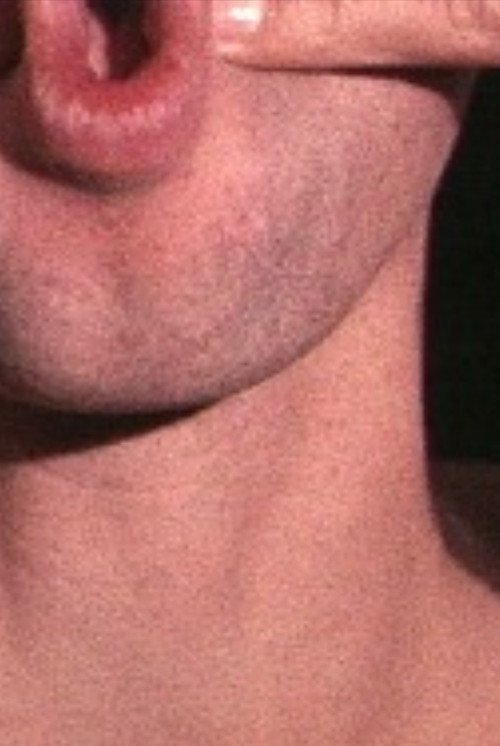 Pinchneck (1968) poster