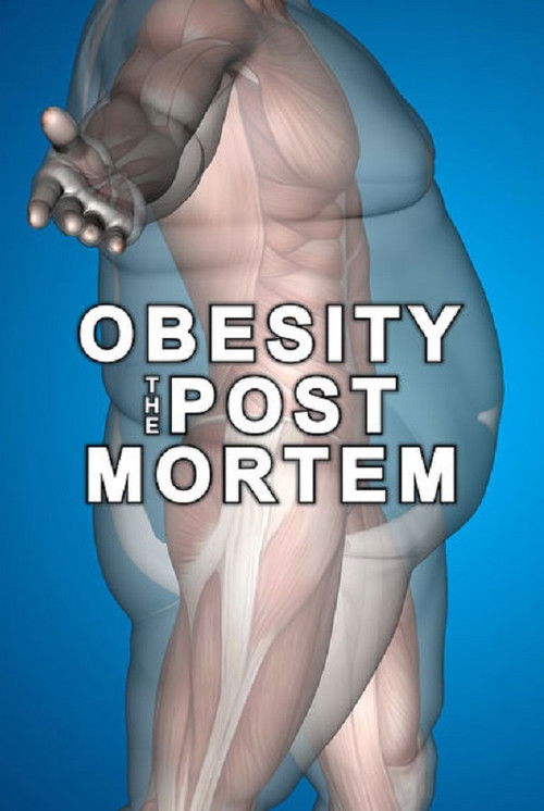 Obesity: The Post Mortem (2016) poster