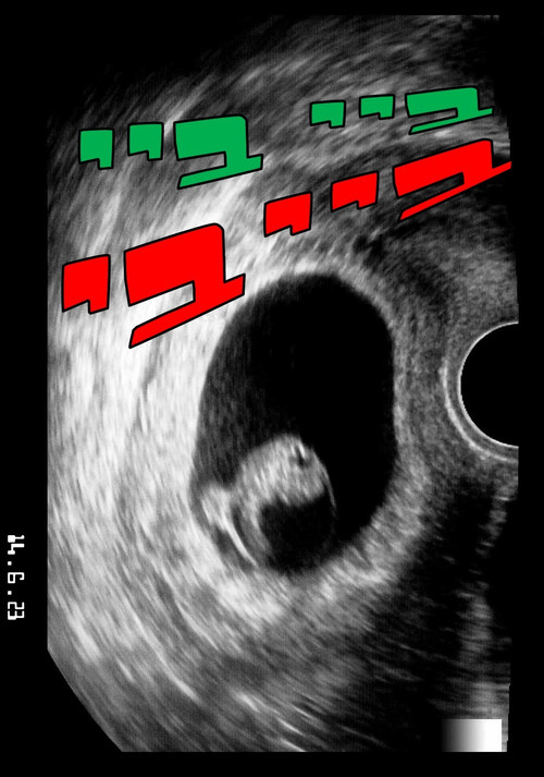 bye bye baby (2023) poster